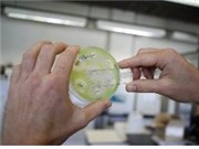 Bóng đá anh, ngoại hạng anh, lịch thi đấu euro 2012, Nhật Bản điều tra toàn quốc vụ nhiễm vi khuẩn kháng đa kháng sinh